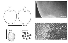  Seed, cotyledon, embryo, and testa:  C. canadensis  A.A. von Bunge - testa SEMs;  C. chinensis  C. Linnaeus - top left cotyledons not investing exposed radicle (L) and embryonic axis (R), bottom far left seed topography;  C.  spp. - bottom left center seeds.
