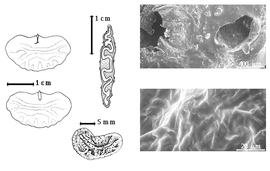  Seed, cotyledon, embryo, and testa:  C. mopane  (T. Kirk ex G. Bentham) T. Kirk ex J.J.G. Léonard - far left cotyledon notched and auriculate and concealing all but tip of radicle (above) and embryonic axis (below), top left center seed in transection, bottom left center seed topography, testa SEMs.
