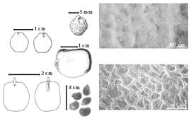  Seed, cotyledon, embryo, and testa:  C. maraviense  D. Oliver - 2nd row top seed topography, 1st row top cotyledons notched and investing exposed radicle (L) and embryonic axis (R), testa SEMs;  C. pellegrinianum  (J.J.G. Léonard) J.J.G. Léonard - 2nd row center seed topography, 1st row bottom cotyledons notched and investing exposed radicle (L) and embryonic axis (R);  C.  spp. - 2nd row bottom seeds.
