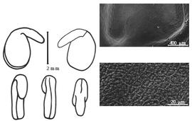  Cotyledon, embryo, and testa:  C. pseudocytisus  (P.E. Boissier) Fertig - embryo, cotyledons, and testa SEMs.
