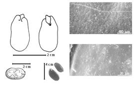  Seed, cotyledon, embryo, and testa:  D. glabrifolia  W.A. Ducke - bottom far left seed topography, top left cotyledon auriculate concealing lower margins of radicle (L) and embryonic axis (R);  D. pennigera  E.L.R. Tulasne - bottom left center seeds, testa SEMs.
