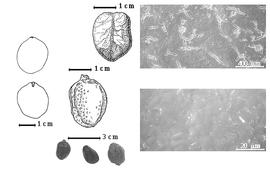  Seed, cotyledon, embryo, and testa:  H. afzelii  (D. Oliver) H.A.T. Harms - top left center seed topography, far left cotyledon split and shallowly notched and concealing all but tip of radicle (above) and embryonic axis (below), testa SEMs;  H. laxiflora  (G. Bentham) H.A.T. Harms - left center seed topography; H. spp. - bottom left center seeds.
