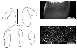  Cotyledon, embryo, and testa:  I. fastigiatum  (E.H.F. Meyer) Schrire - embryo, cotyledons, testa SEMs.
