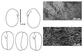  Cotyledon, embryo, and testa:  O. burchellii  A.P. de Candolle - embryo, cotyledons, and testa SEMs.
