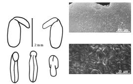  Cotyledon, embryo, and testa:  O. robustum  J. Thompson - embryo, cotyledons, and testa SEMs.
