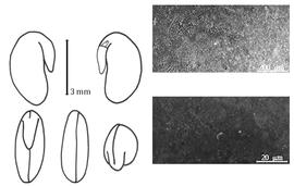  Cotyledon, embryo, and testa:  P. esculentum  (F.T. Pursh) P.A. Rydberg - embryo, cotyledons, and testa SEMs.
