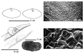  Seed, cotyledon, embryo, and testa:  P. africana  (J.D. Hooker) J.P.M. Brenan - top left cotyledon not concealing radicle (L) and embryonic axis (R), center left dehiscent fruit with seed in situ, bottom center seed, testa SEMs.
