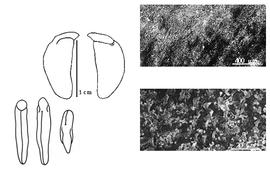  Cotyledon, embryo, and testa:  P. erinaceus  J.L.M. Poiret - embryo, cotyledons, and testa SEMs.
