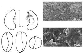  Cotyledon, embryo, and testa:  S. macrobotrys  A. Gray - embryo, cotyledons, and testa SEMs.
