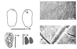  Seed, cotyledon, embryo, and testa:  T.  spp. - top left cotyledon notched and barely auriculate and concealing margins (but not base) of radicle (L) and embryonic axis (R), bottom left seed topography, bottom left center seeds, testa SEMs.
