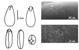  Cotyledon, embryo, and testa:  T. retusa  (É.P. Ventenat) R. Brown - embryo, cotyledons, and testa SEMs.
