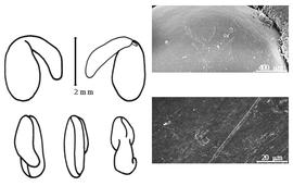  Cotyledon, embryo, and testa:  U. parviflorus  P.A. Pourret de Figeac - embryo, cotyledons, and testa SEMs.
