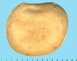  Lupinus albus.  Seeds with some indentations on the surface. 