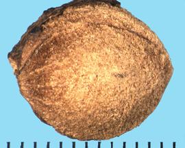 Prunus minutiflora . Pits that are a seed enclosed in the inner part (endocarp) of the fruit coat.