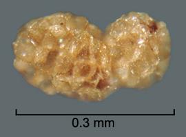  Aeginetia indica.  Coarsely reticulate texture. Photo by Julia Scher, USDA-APHIS-PPQ.