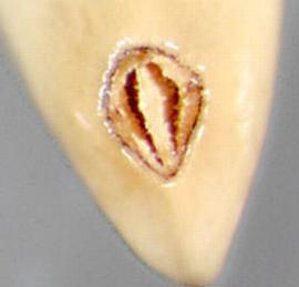  Carthamus oxyacanthus.  Achenes with a long hilum that is lateral to the base. Photo by Julia Scher, USDA-APHIS-PPQ.