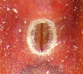  Galega officinalis . Small circular hilum. Photo by Julia Scher, USDA-APHIS-PPQ.
