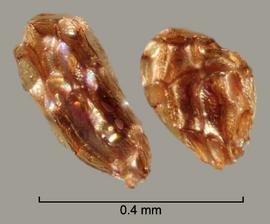  Orobanche artemisiae-campestri.  Seeds with reticulations that have shiny walls and stippled bases. Photo by Julia Scher, USDA-APHIS-PPQ.