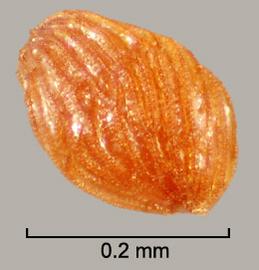  Striga asiatica . Small true seeds with detailed markings. Photo by Julia Scher, USDA-APHIS-PPQ.