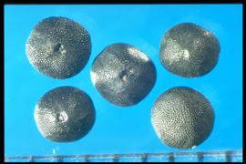  Vaccaria hispanica.  True seeds that are totally round with only a trace of cells forming a line half the way around the seed. 