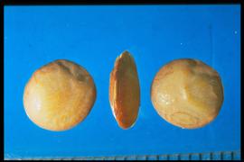  Lens culinaris.  Lenticular seeds with sharp margins. Photo courtesy of Colorado State University, Department of Soil and Crop Sciences.