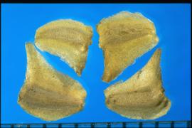  Glebionis carinatum.  Achenes with sharp margins and the opposite margins are concave and convex. 
