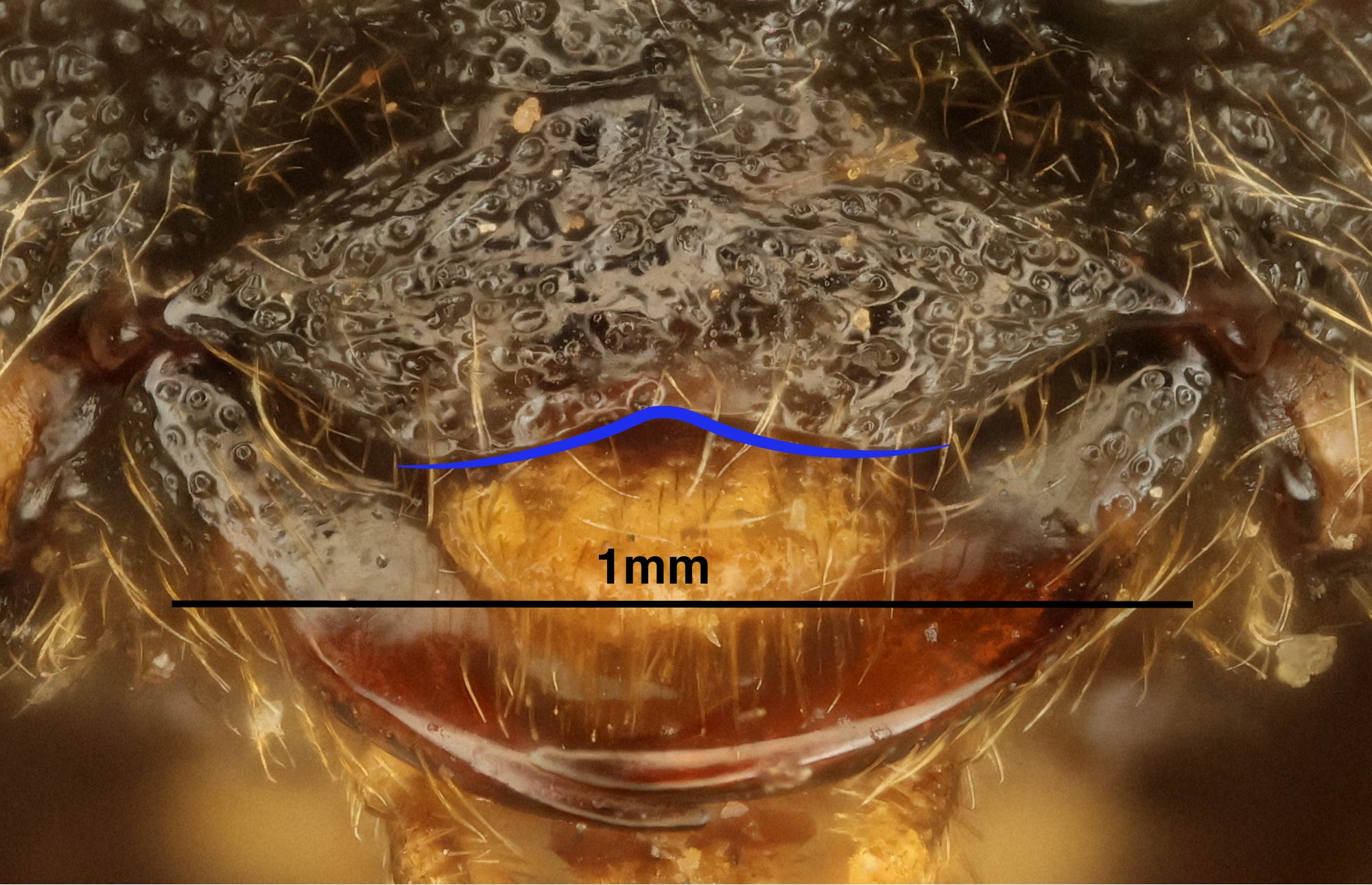 Anterior clypeal margin (marked in blue), <em>Diprion pini</em>