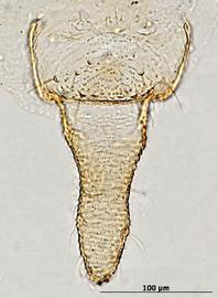 Brachycorynella asparagi | AphID