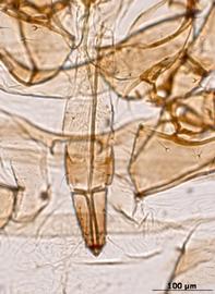 Rhopalosiphum padi | AphID