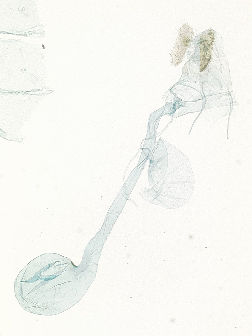 Female genitalia. © James Hayden, FDACS-DPI. Image used with permission. 
 